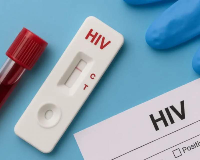 هشدار درباره تغییر الگوی انتقال HIV؛ انتقال جنسی در صدر موارد جدید