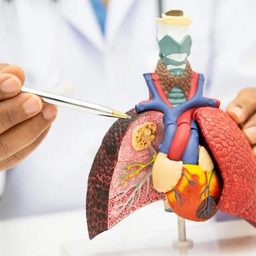 ترکیب Imdelltra و Imfinzi بقای بیماران سرطان ریه سلول کوچک را بهبود داد